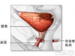 膀胱炎的发病原因有哪些