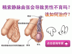 贝康医生讲解精索静脉曲张的症状及病因