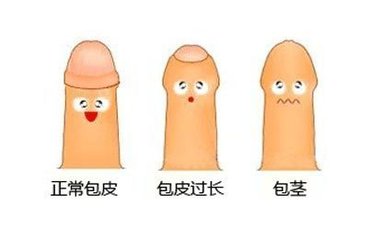 包皮过长的这些危害你真的知道吗