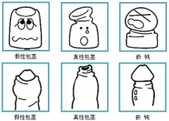 要了解包茎有哪些症状危害